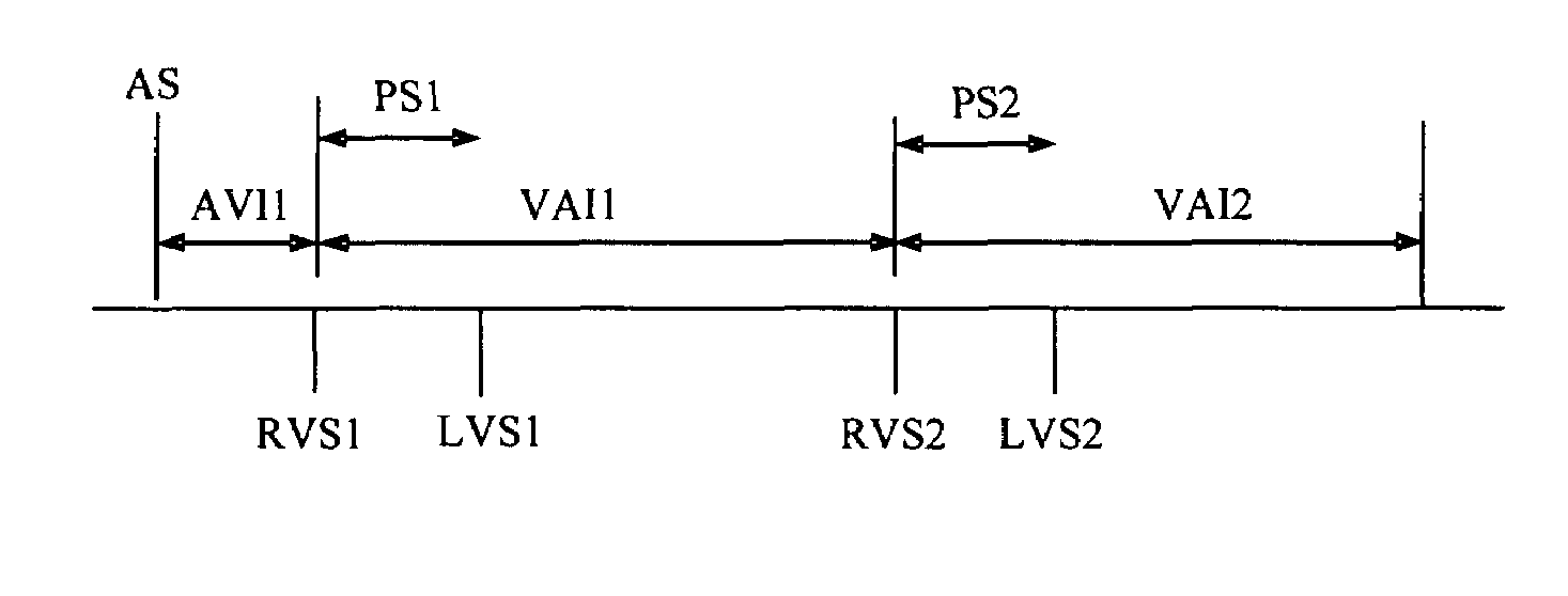 Timing cycles for synchronized multisite cardiac pacing