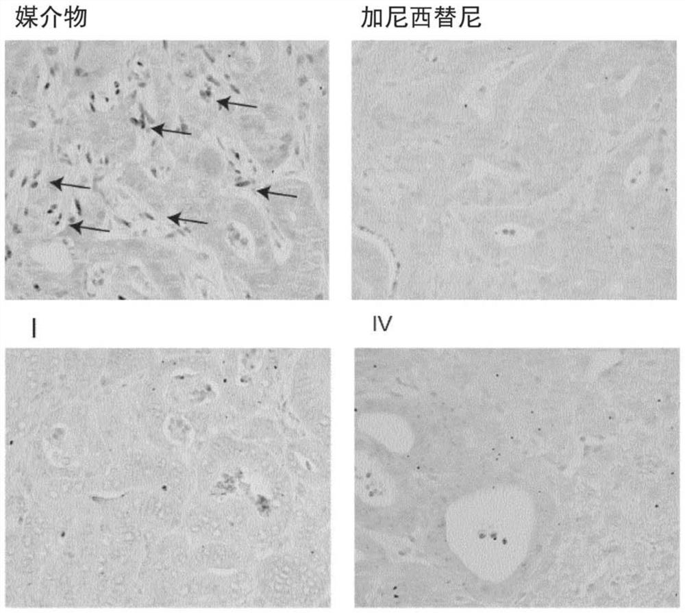 TGF Beta INHIBITOR AND PRODRUGS