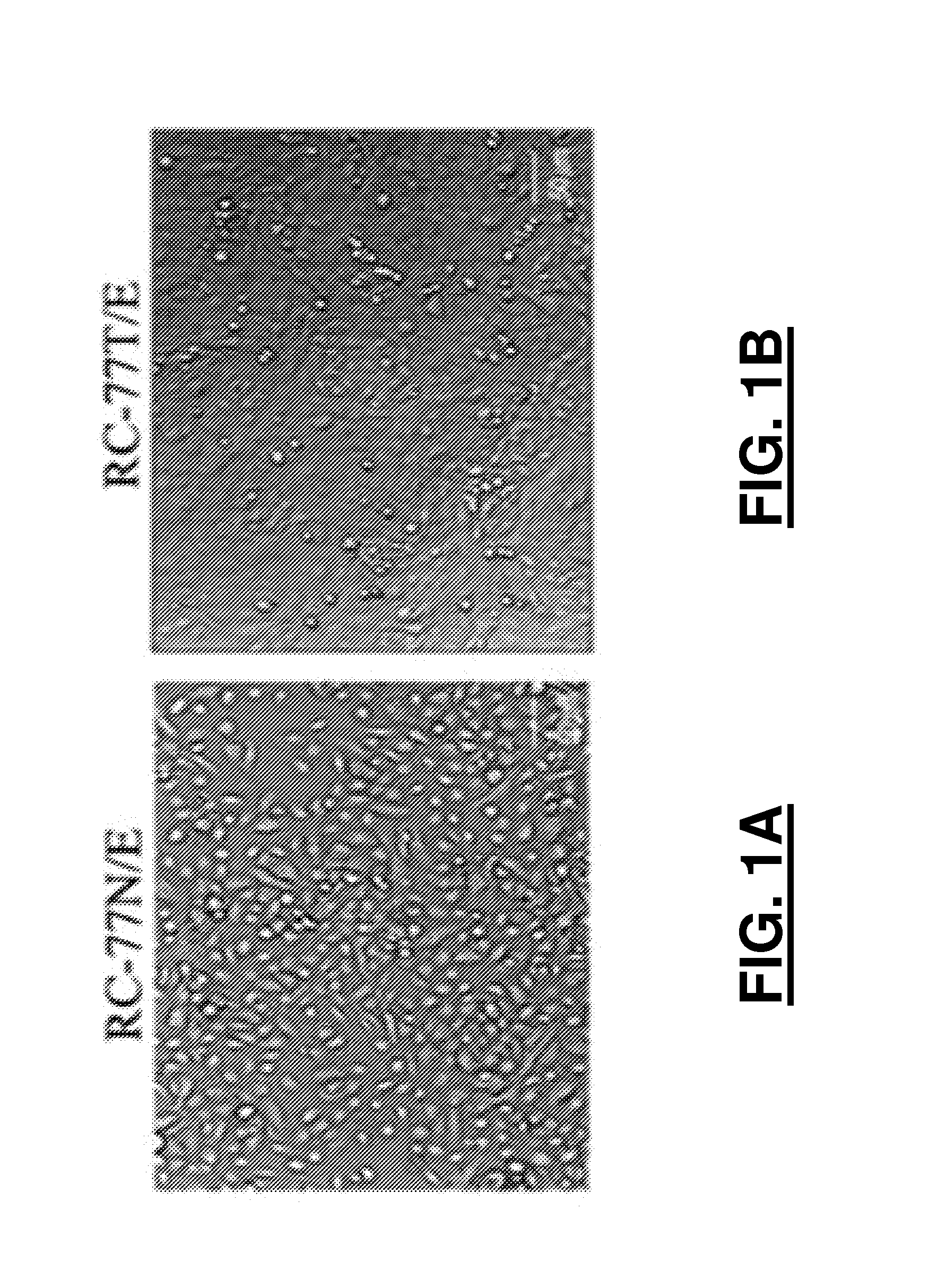 Immortalized human prostate cell lines