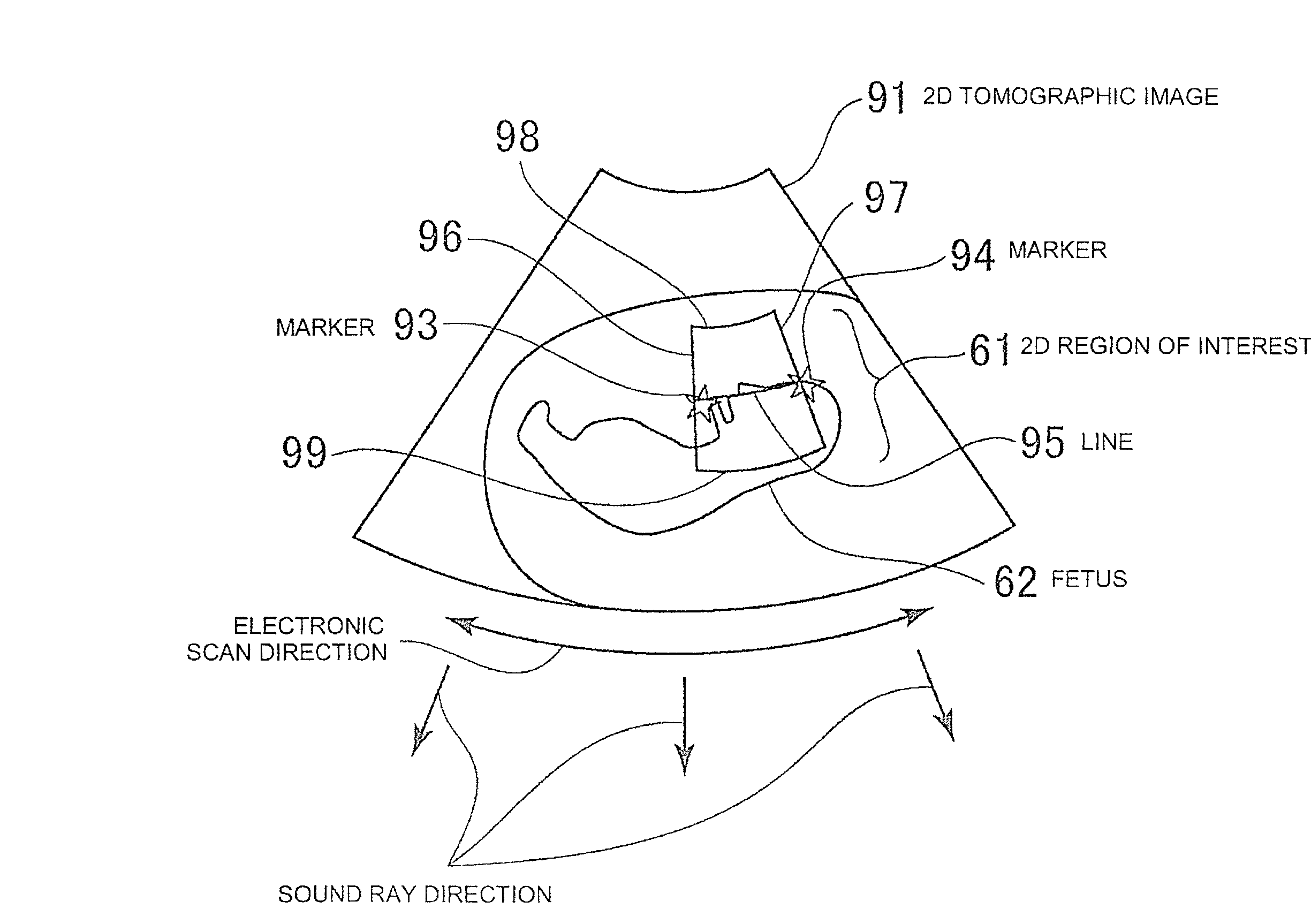 Ultrasonic imaging apparatus and image processing apparatus