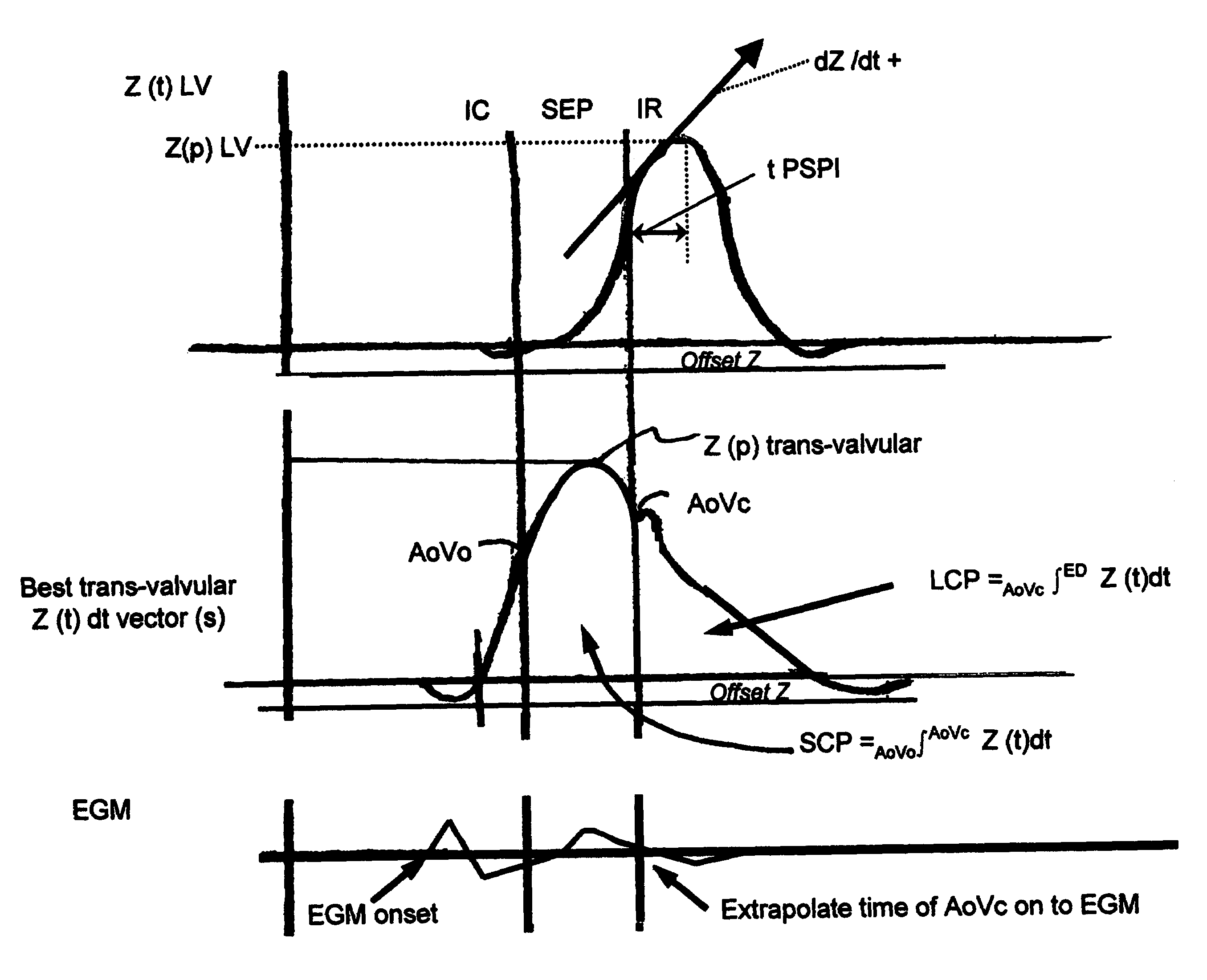 Optimization of impedance signals for closed loop programming of cardiac resynchronization therapy devices