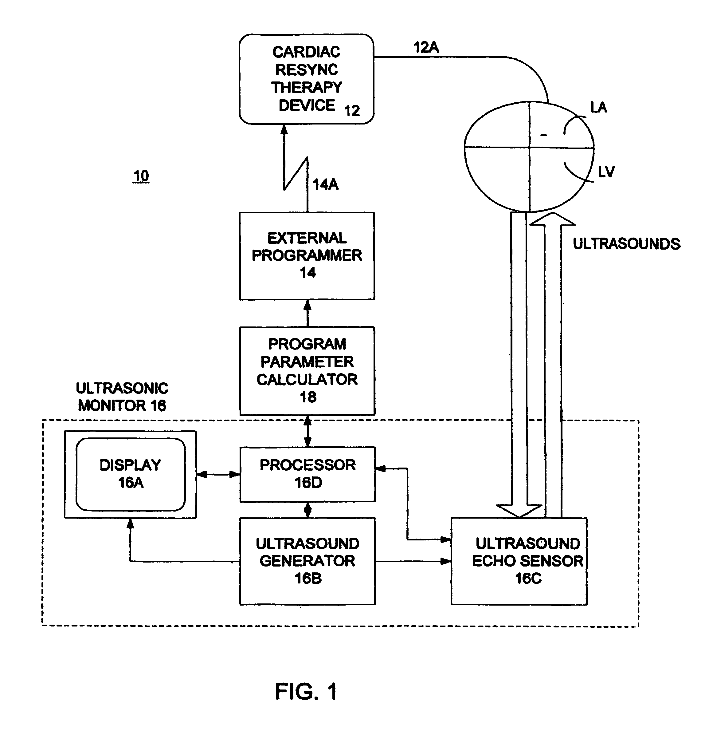 Optimization of impedance signals for closed loop programming of cardiac resynchronization therapy devices