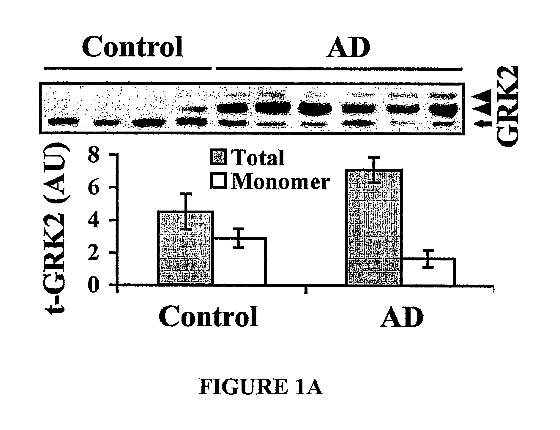 Method of detecting and preventing Alzheimer's disease, particularly at prodromal and early stages