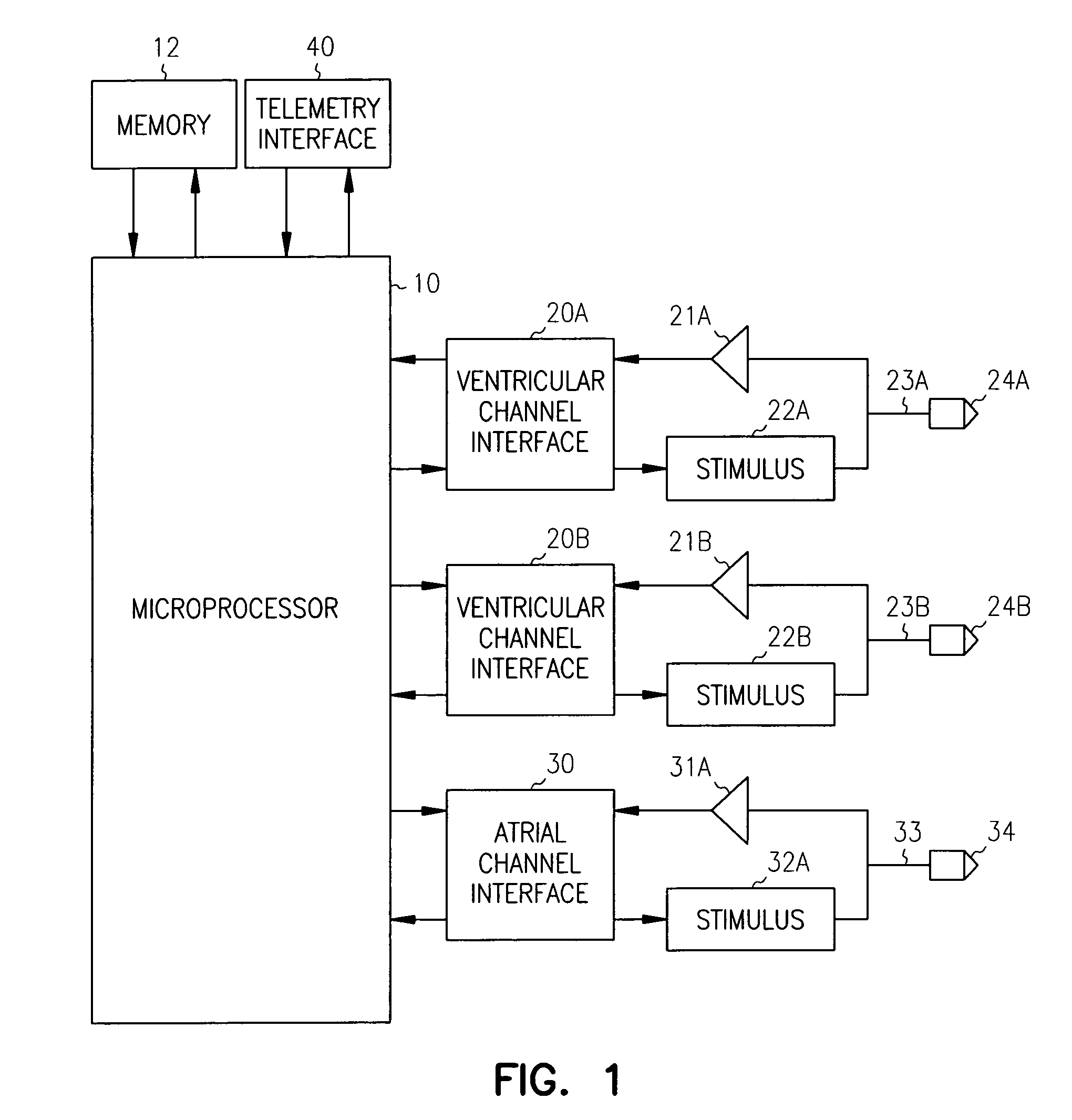 Ventricular conduction delay trending system and method