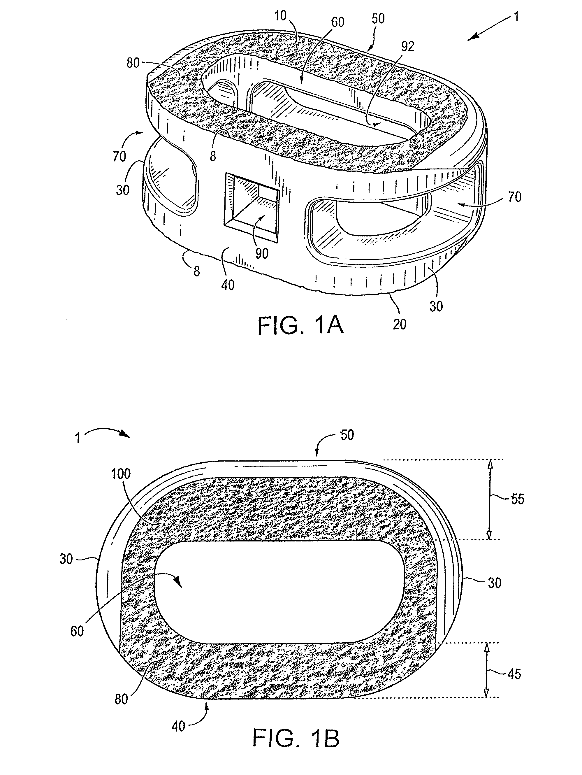 Endplate-preserving spinal implant with an integration plate having durable connectors