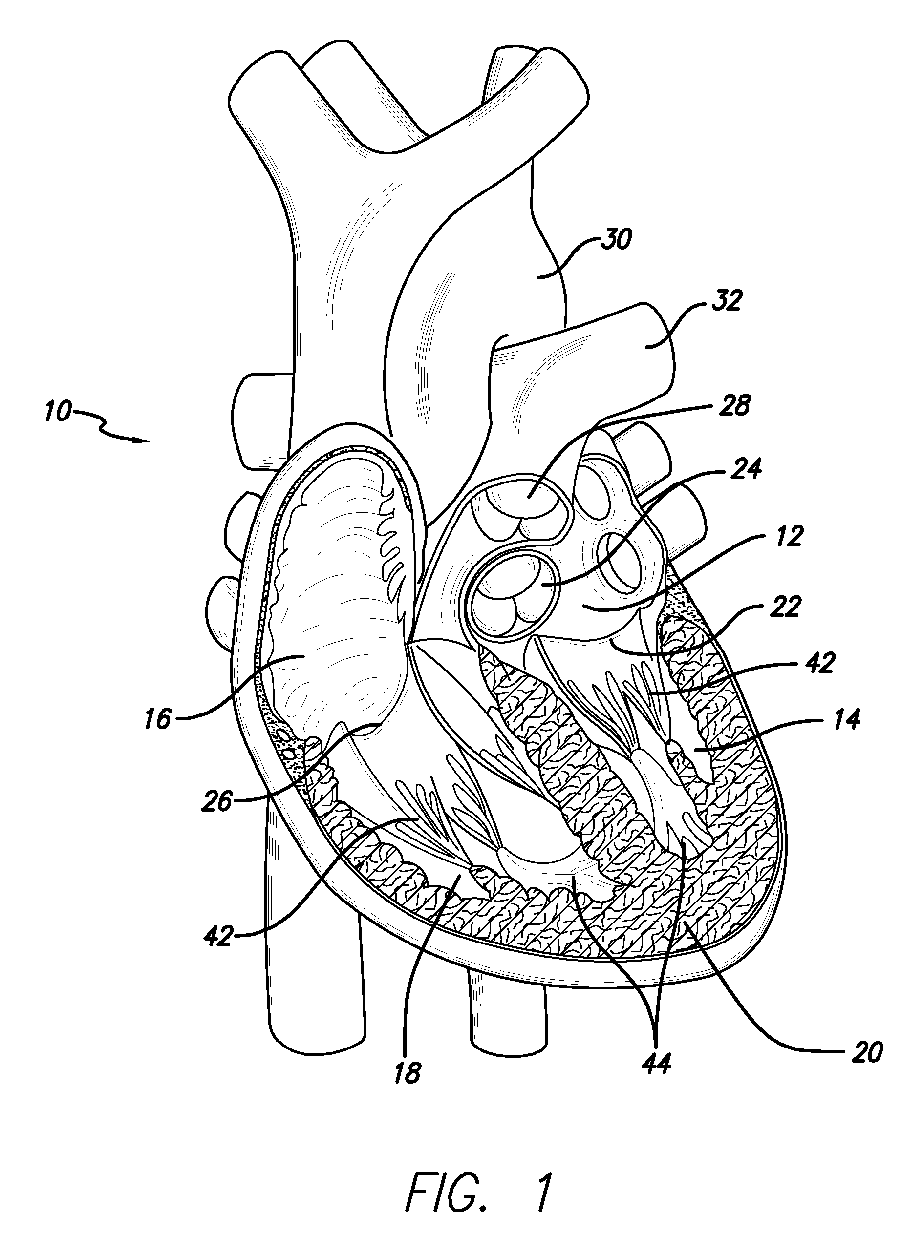 Methods and devices for performing cardiac valve repair