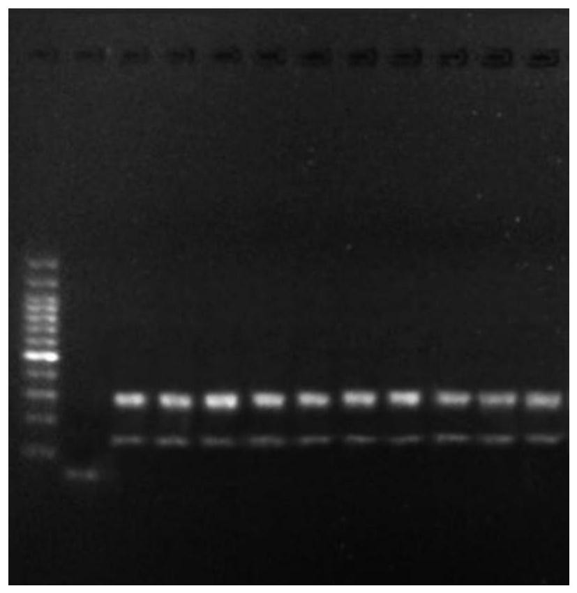 PCR-specific primers, detection kits and detection methods for genes related to benign and malignant thyroid nodules