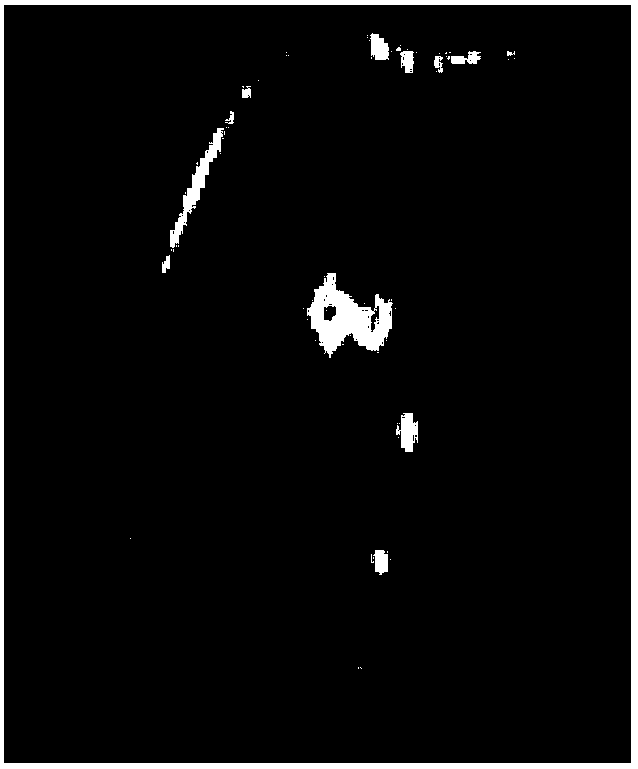 Method for reconstructing sparse MRI (Magnetic resonance imaging) based on convolutional neural network in combination with iterative method