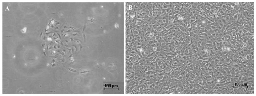 Rhabdovirus-sensitive eel kidney tissue cell line and its application