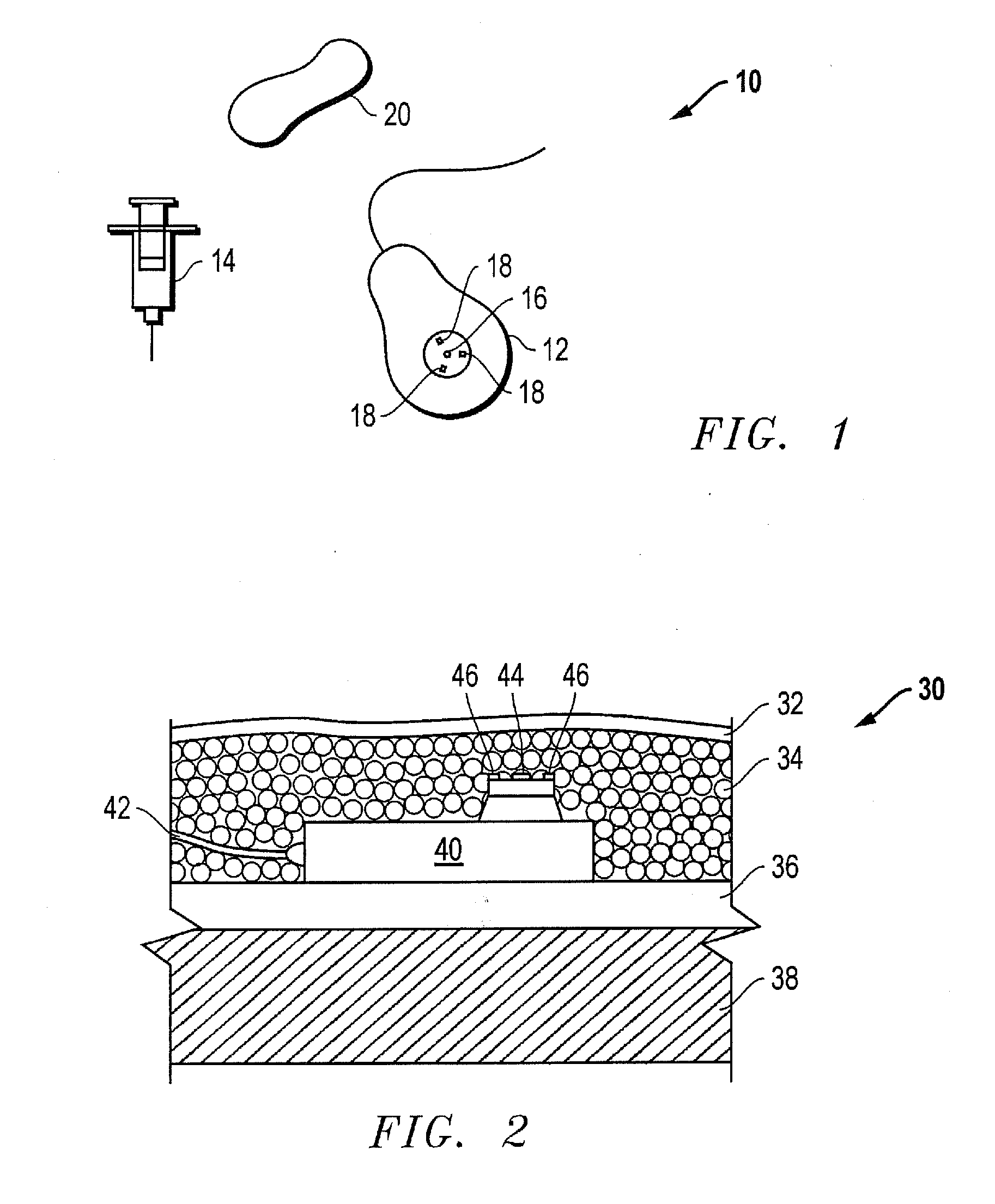 Access port indicator for implantable medical device