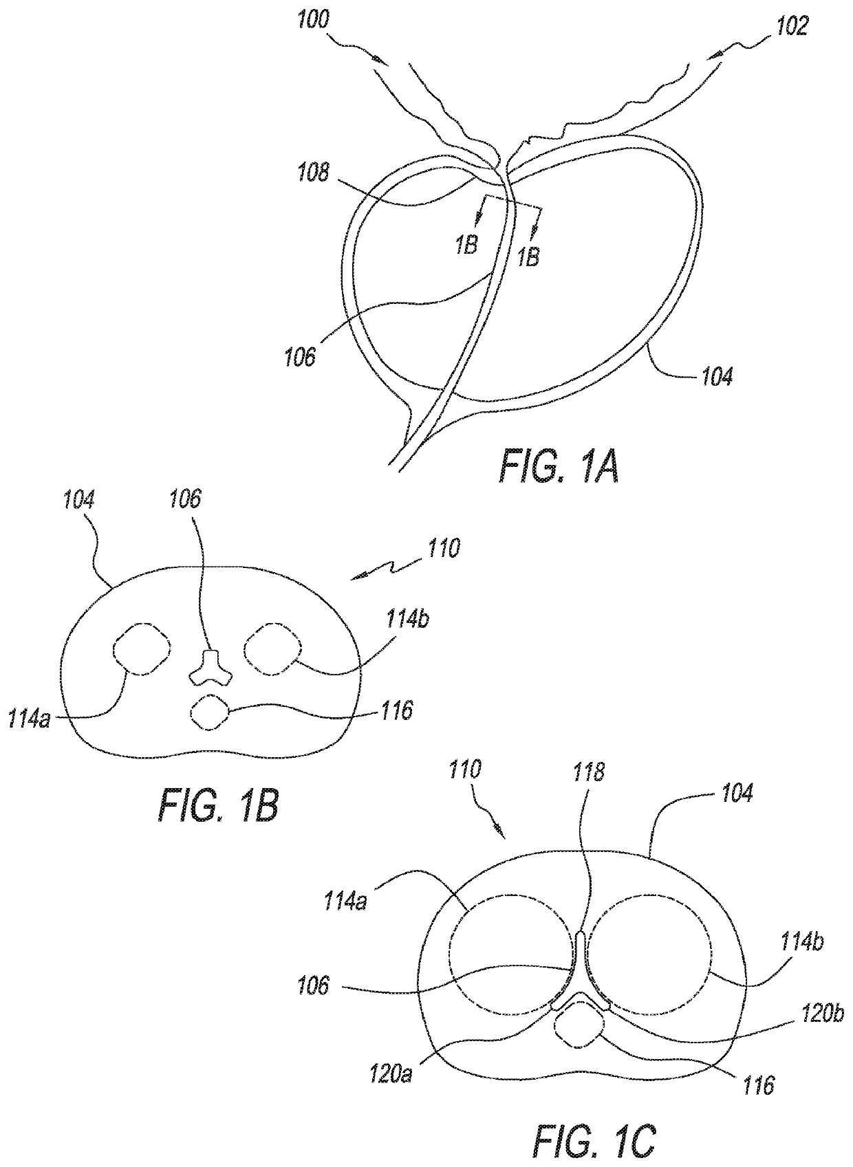 Retracting or/and supporting periurethral tissue