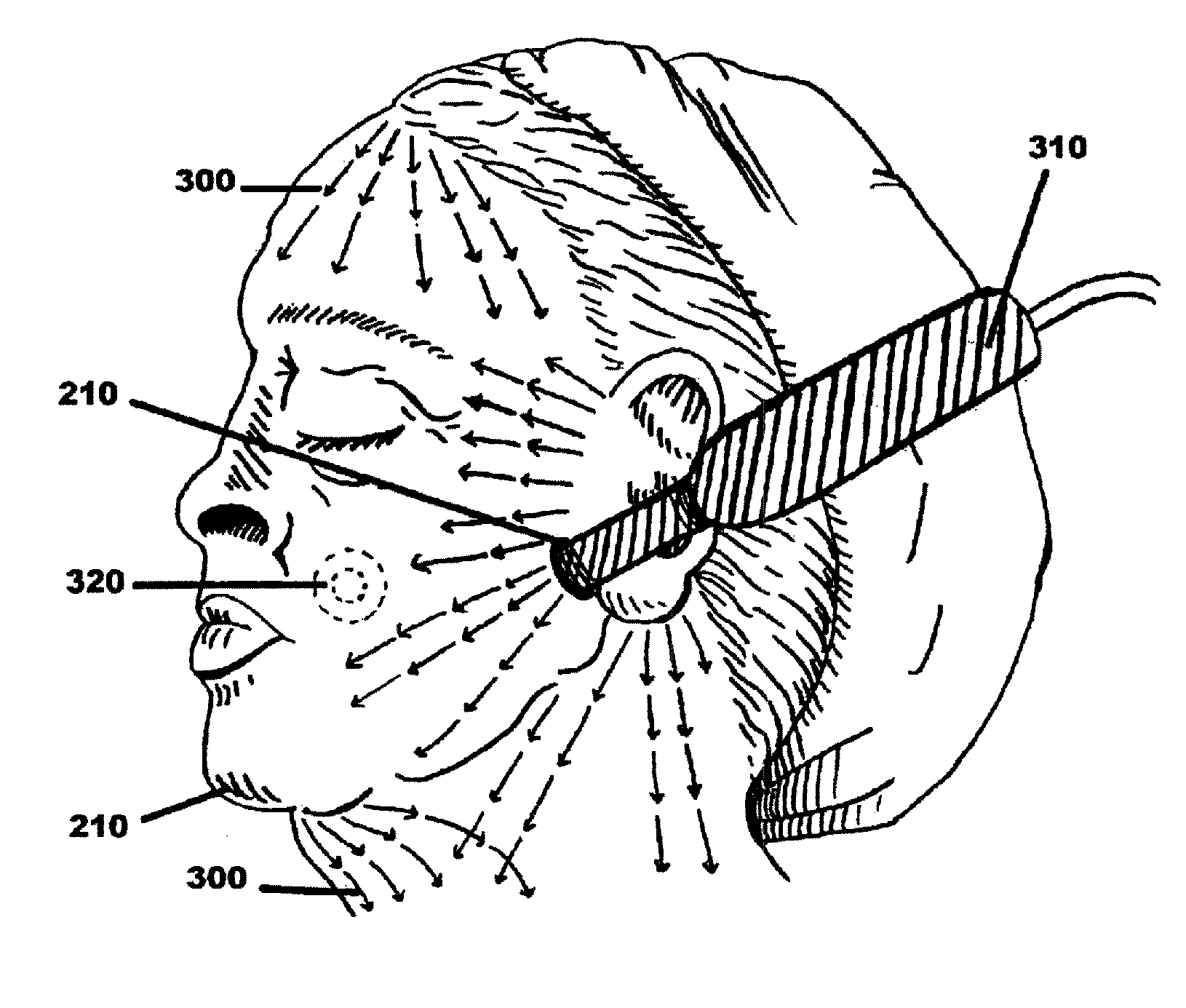 Facial tissue strengthening and tightening device and methods