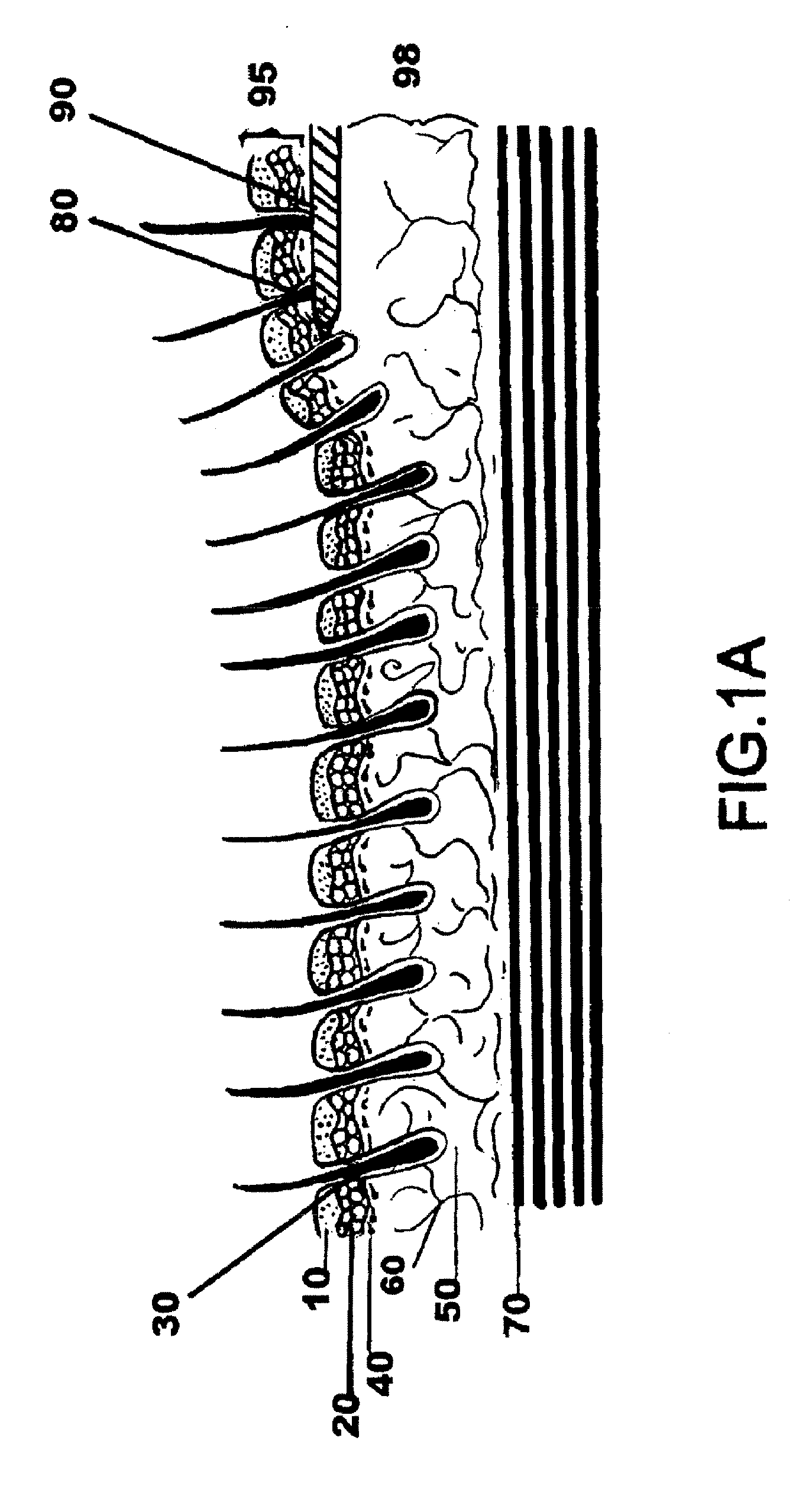 Facial tissue strengthening and tightening device and methods