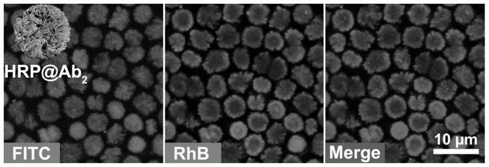 Protein-inorganic nanoflower with controllable protein distribution and size as well as preparation method and application of protein-inorganic nanoflower