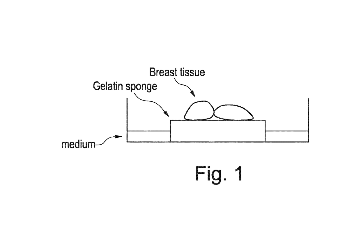 Agents inhibiting granulin for treatment of cancer