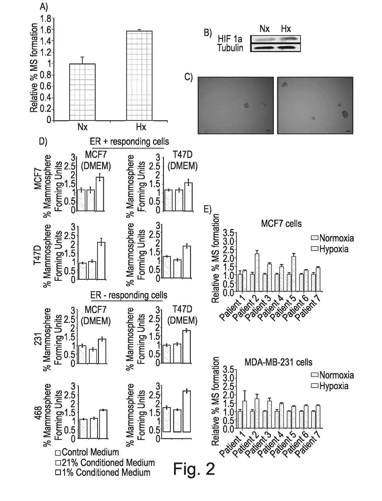 Agents inhibiting granulin for treatment of cancer