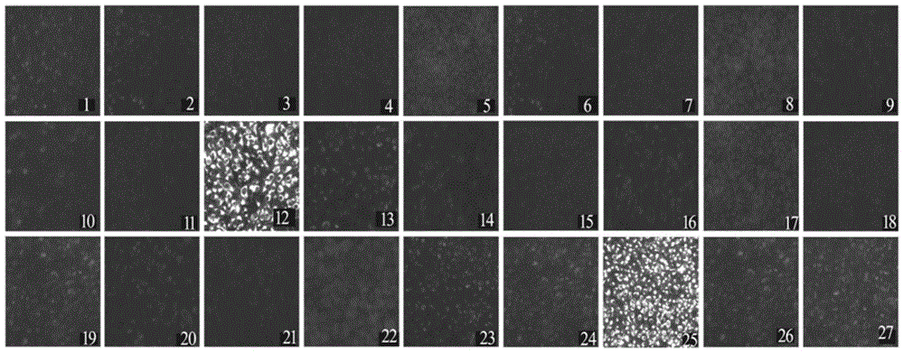 Monoclonal antibody BTV12-NS1-1F8 of anti-bluetongue-virus 12-type NS1 protein, B cell epitope recognized by monoclonal antibody and application of monoclonal antibody