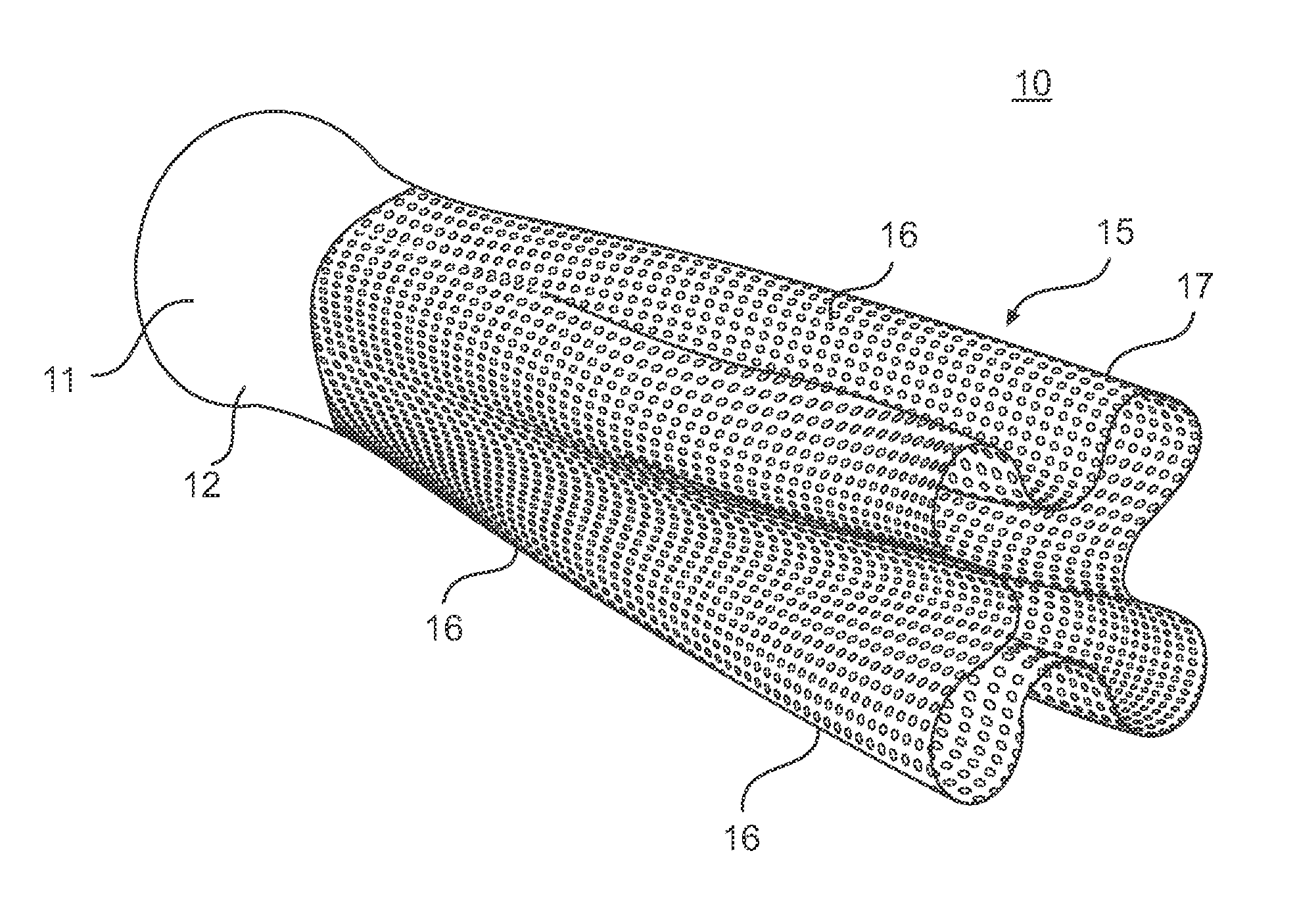 Pre-converter device for cleaning exhaust gas for an internal combustion engine