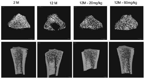 Application of deferoxamine mesylate for injection in treating senile bone loss and bone marrow stem cell aging