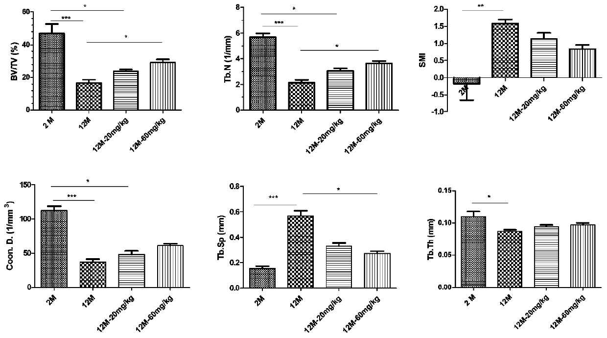 Application of deferoxamine mesylate for injection in treating senile bone loss and bone marrow stem cell aging