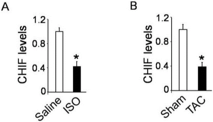 CircRNA CHIF nucleotide and pharmaceutical composition comprising such nucleotide and application thereof