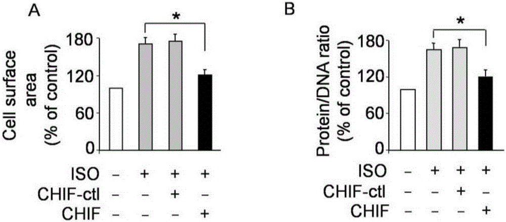 CircRNA CHIF nucleotide and pharmaceutical composition comprising such nucleotide and application thereof