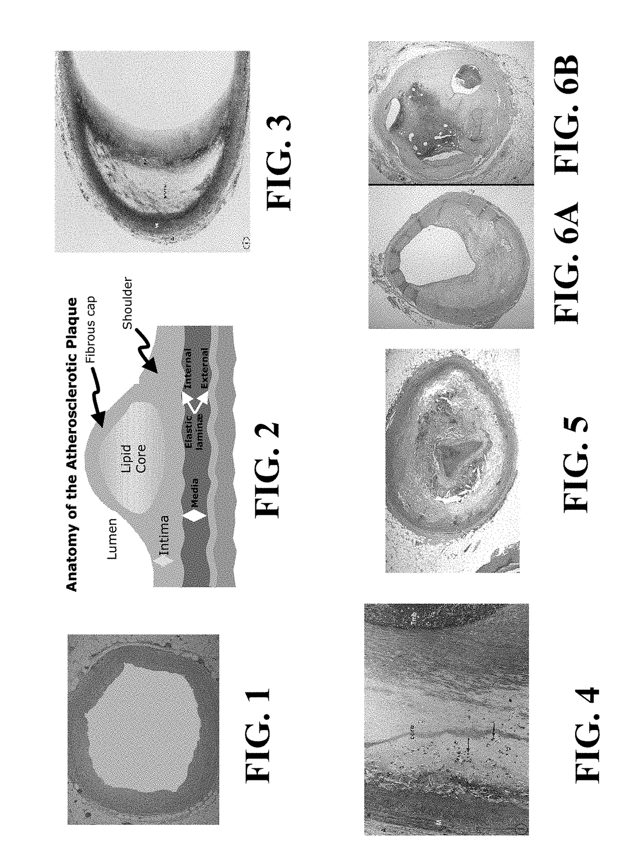 Methods of computing pericardial and abdominal fat and methods for motion compensation