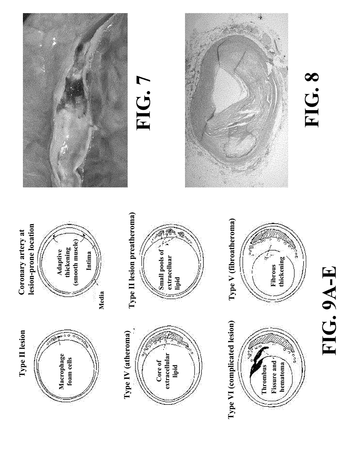 Methods of computing pericardial and abdominal fat and methods for motion compensation