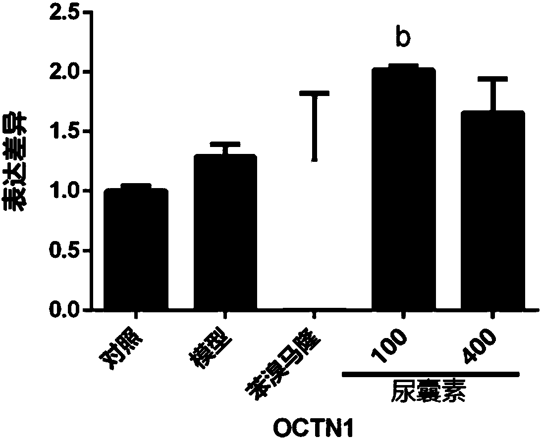 Application of urea in preparation of drugs resisting hyperuricemia and gout