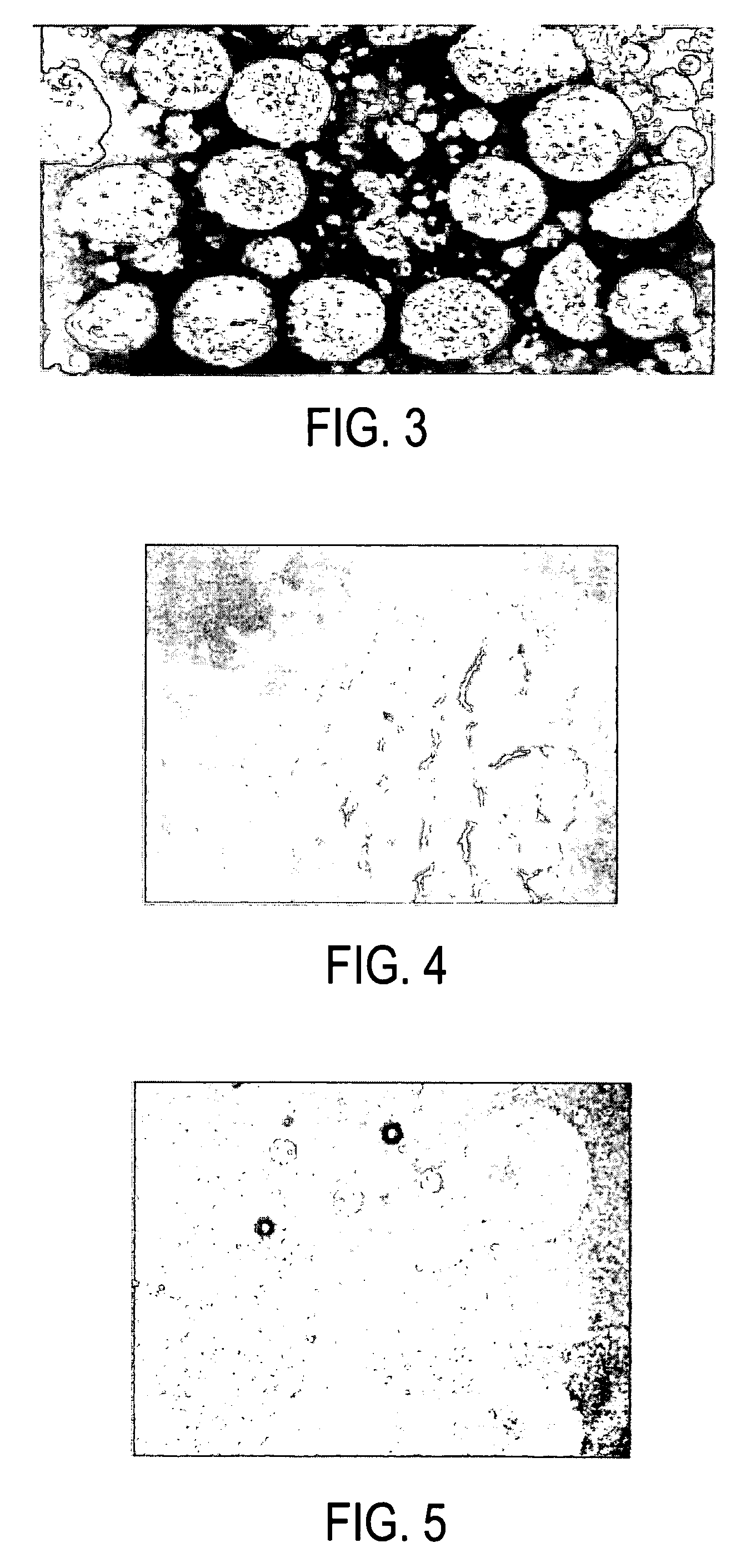 Long acting injectable insulin composition and methods of making and using thereof