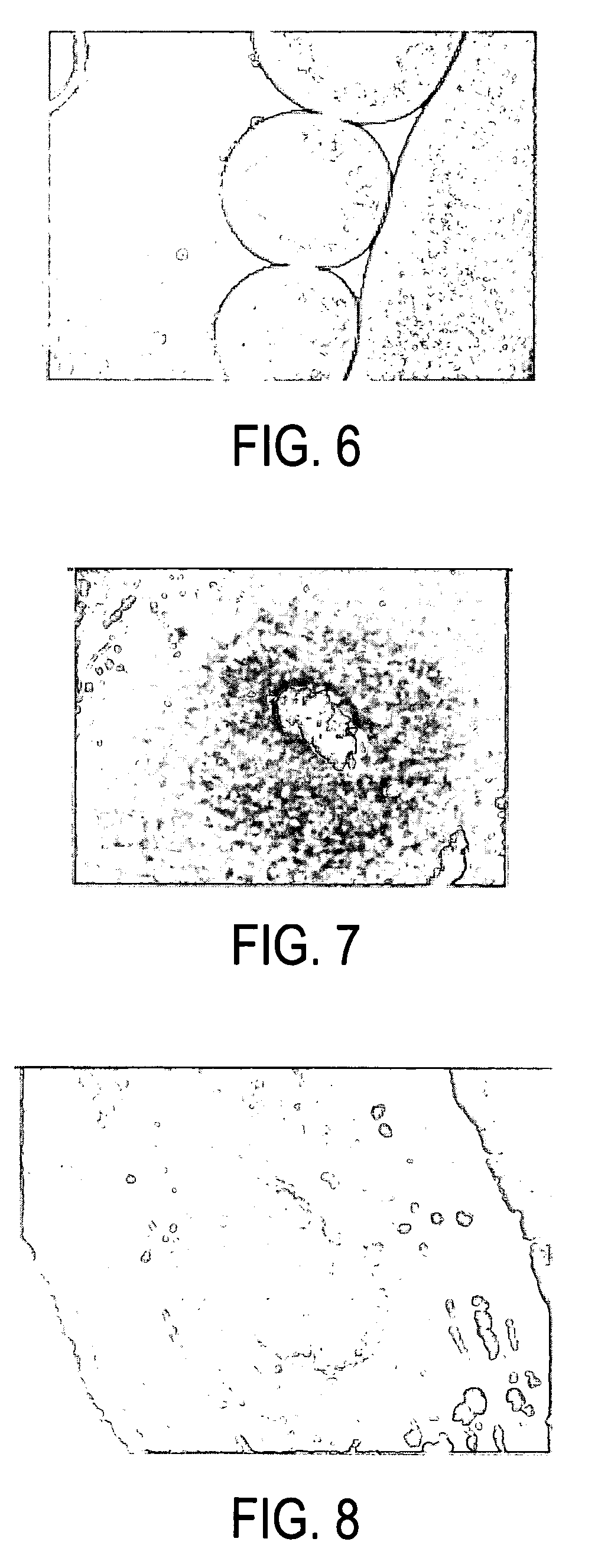 Long acting injectable insulin composition and methods of making and using thereof