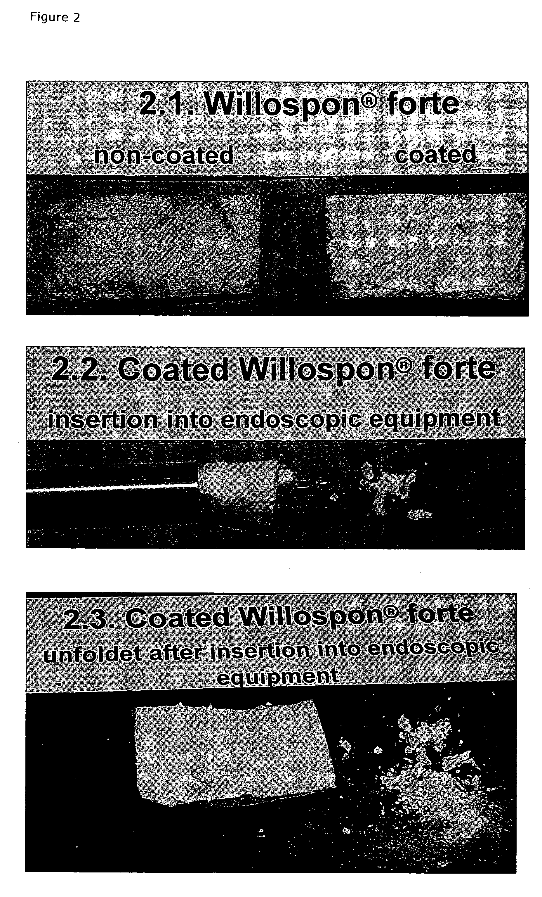 Carrier with solid fibrinogen and solid thrombin