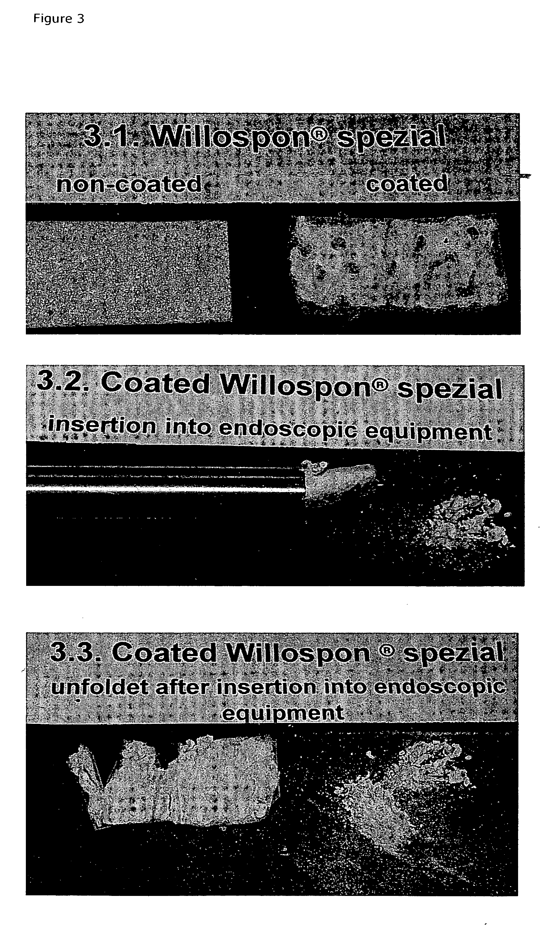 Carrier with solid fibrinogen and solid thrombin