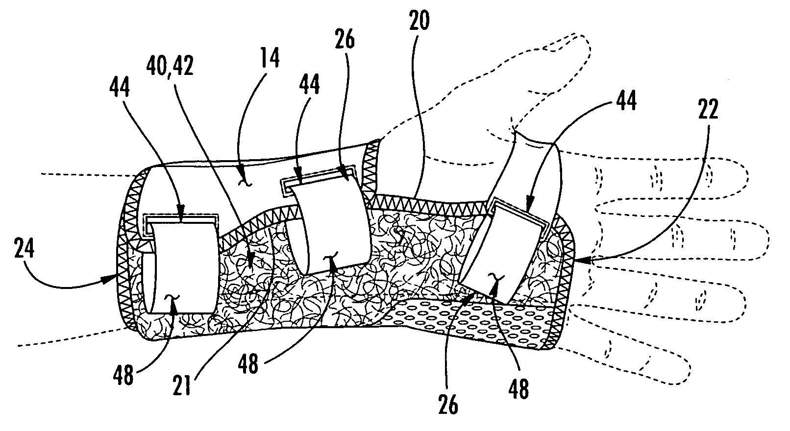 Wrist brace having continuous loop straps and method of using the same