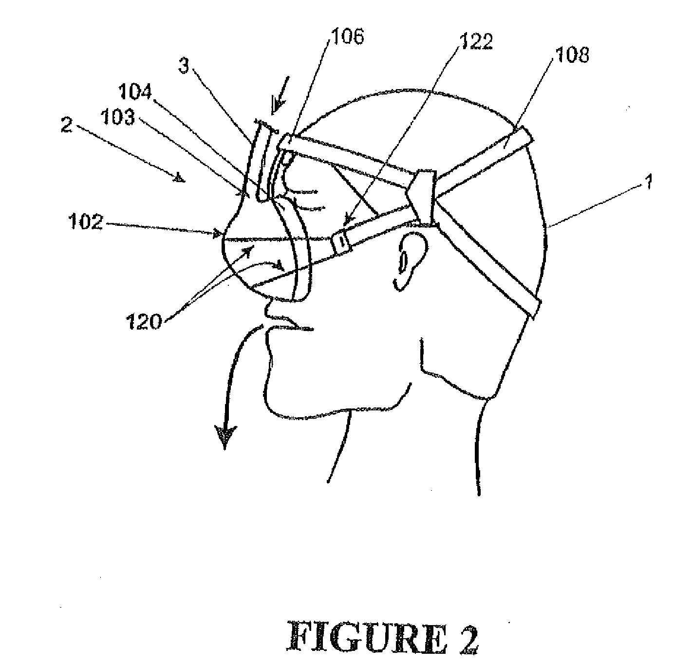 Breathing assistance apparatus