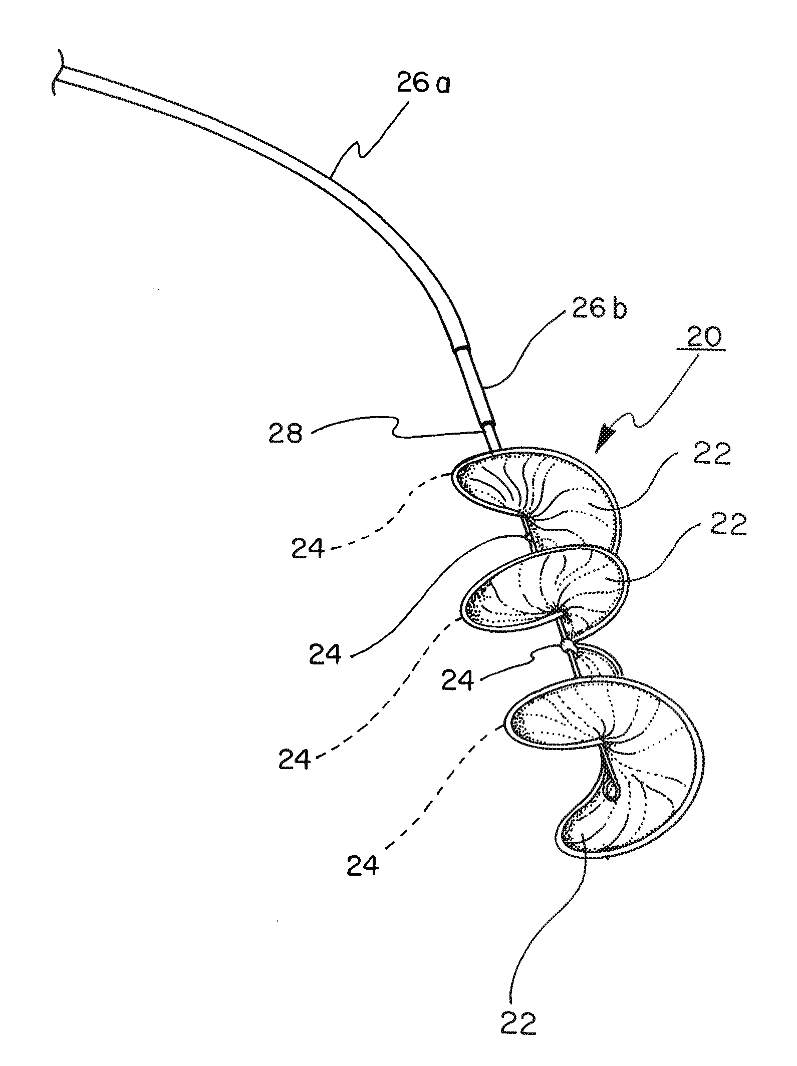 Implantable product with improved aqueous interface characteristics and method for making and using same