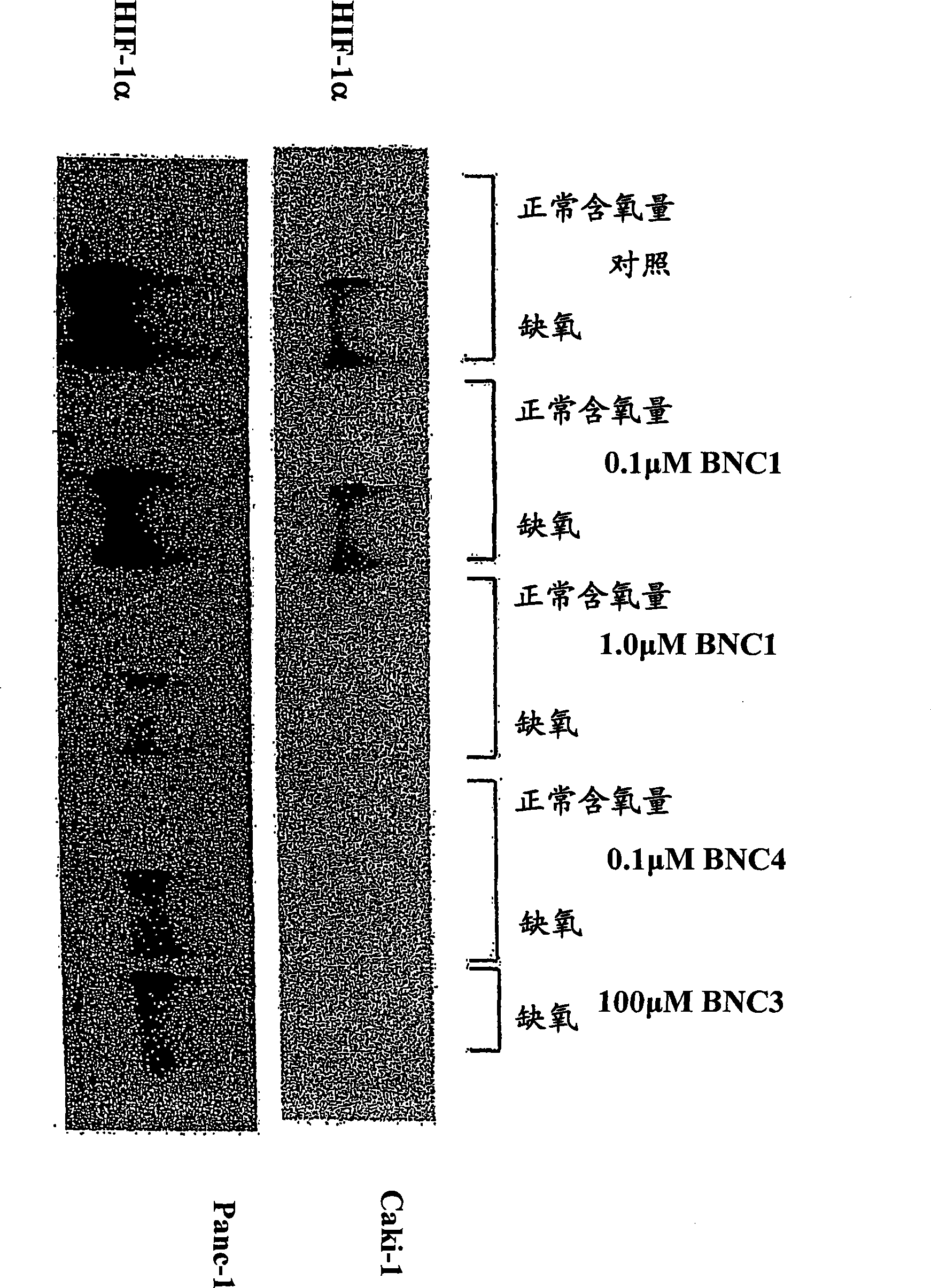 Modulators of hypoxia inducible factor-1 and related uses