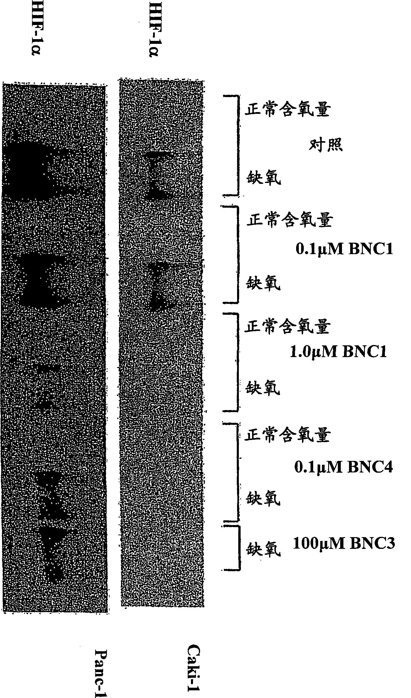 Modulators of hypoxia inducible factor-1 and related uses