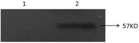 Kit for detecting avian onfectious synovitis antibody and preparation method