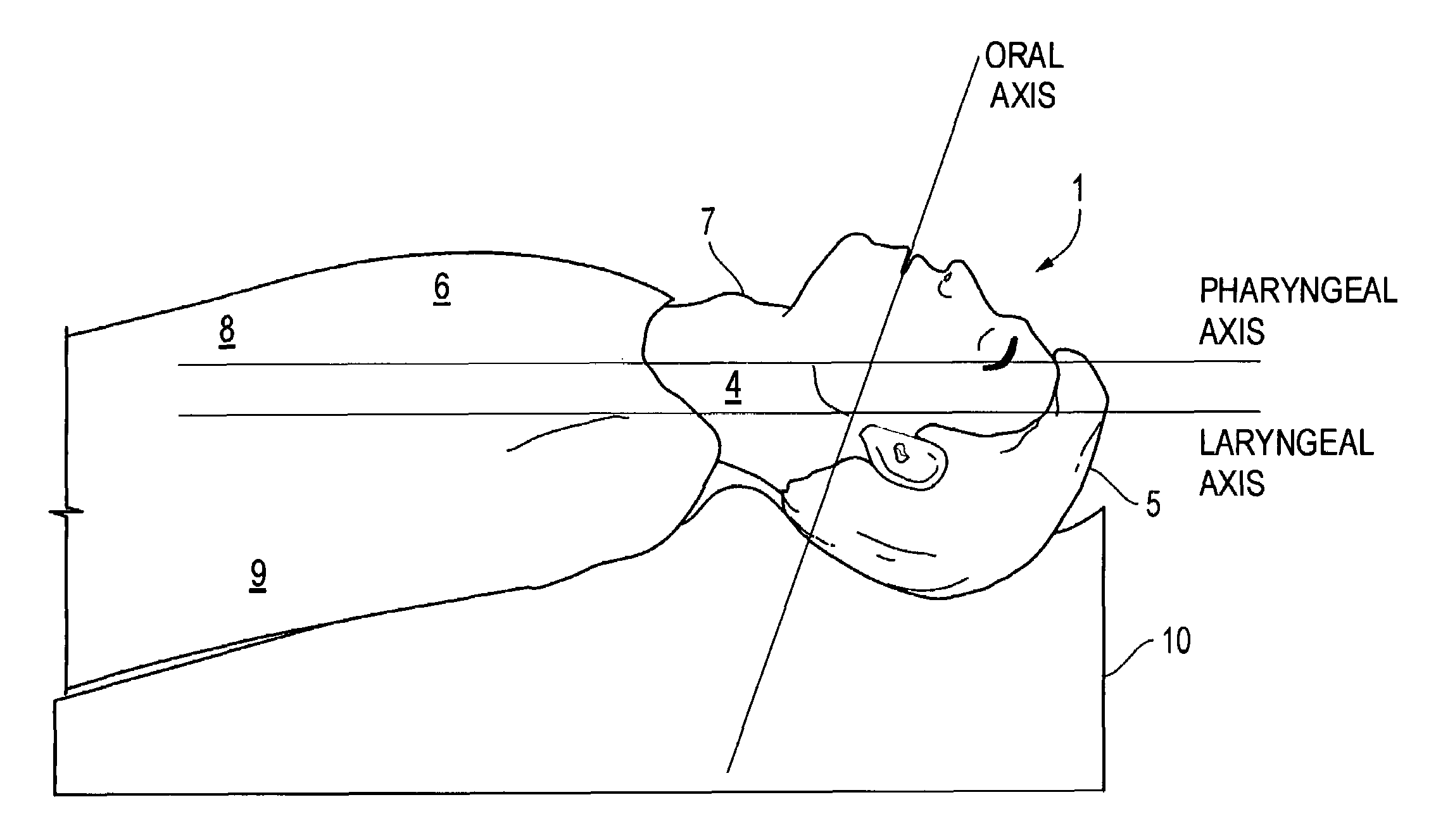 Airway management method