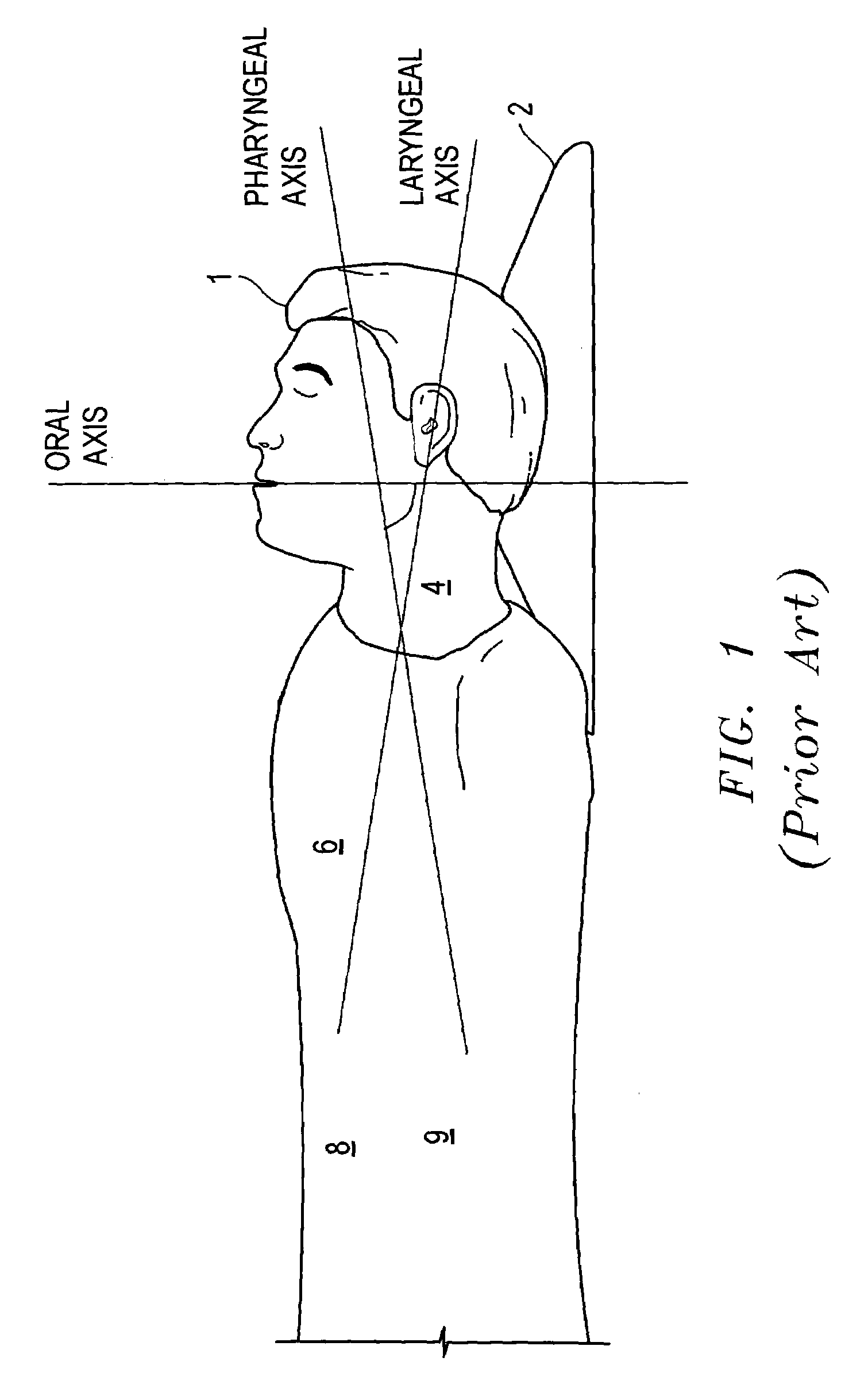 Airway management method