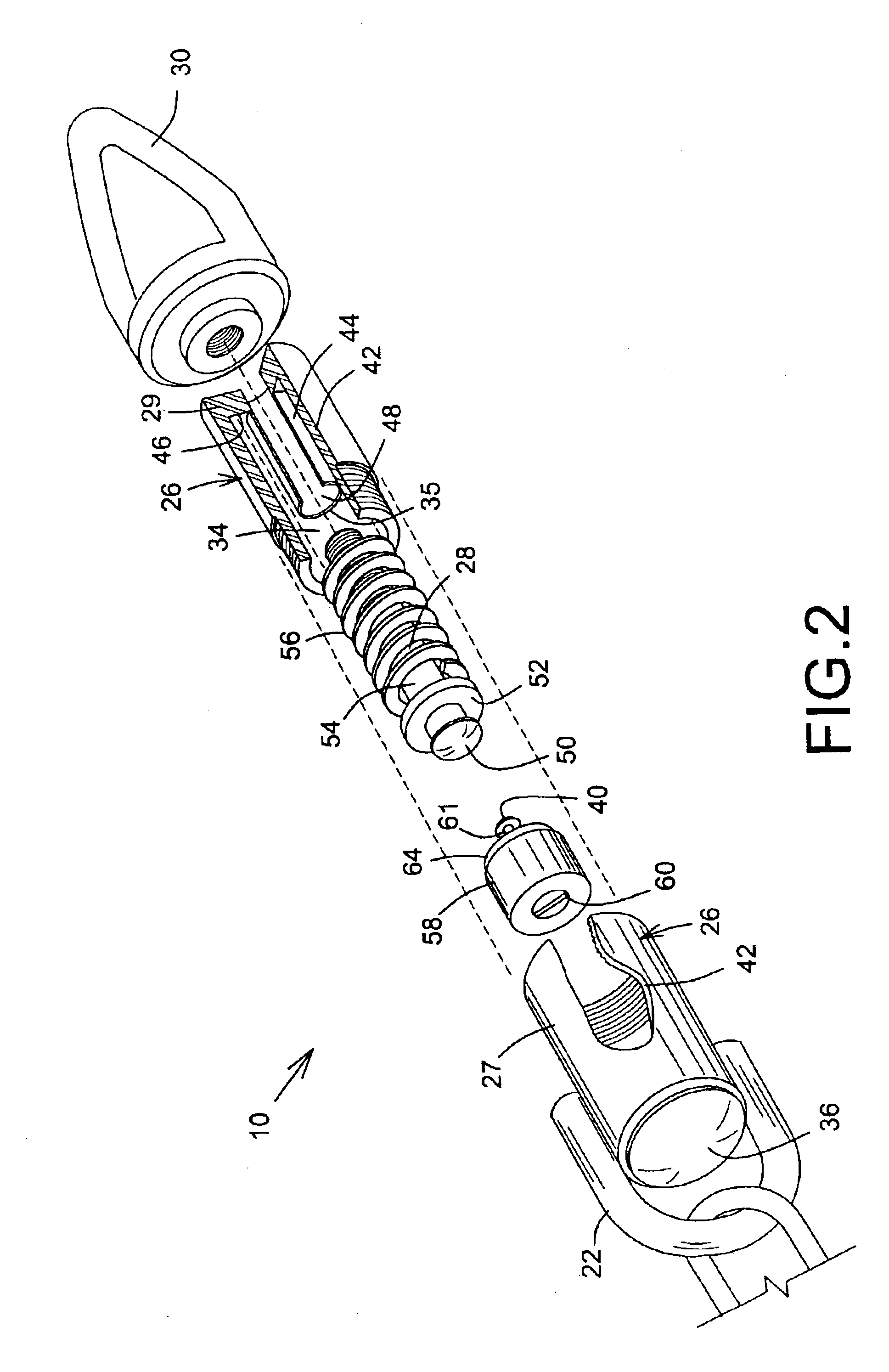 Load tension alert device