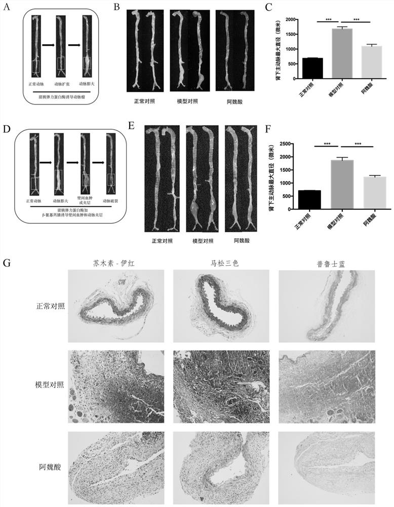 Medicine for treating artery-related diseases and application thereof