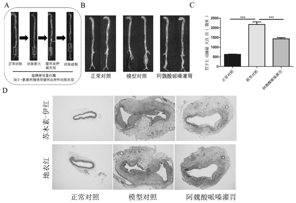 Medicine for treating artery-related diseases and application thereof