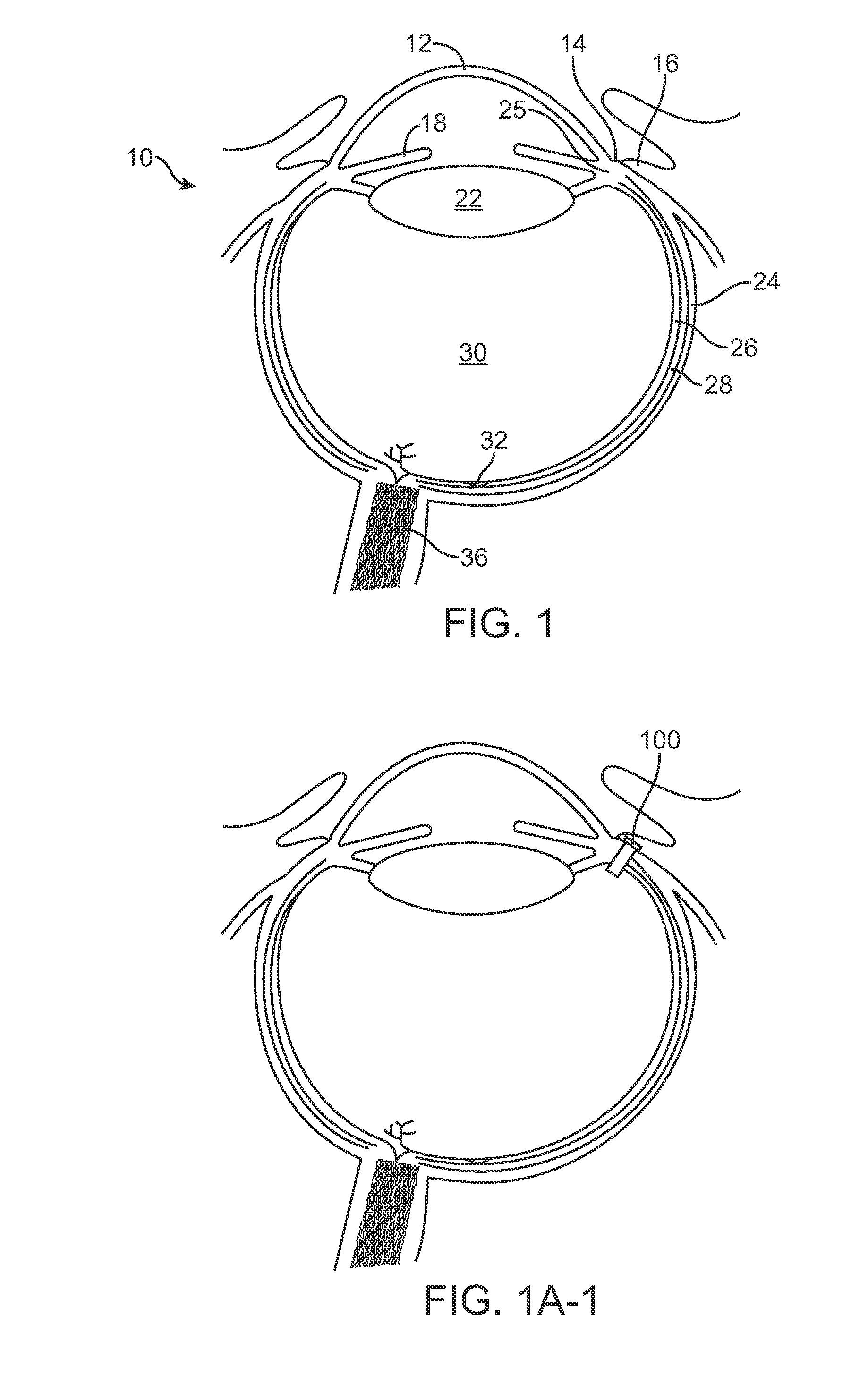 Injector apparatus and method for drug delivery