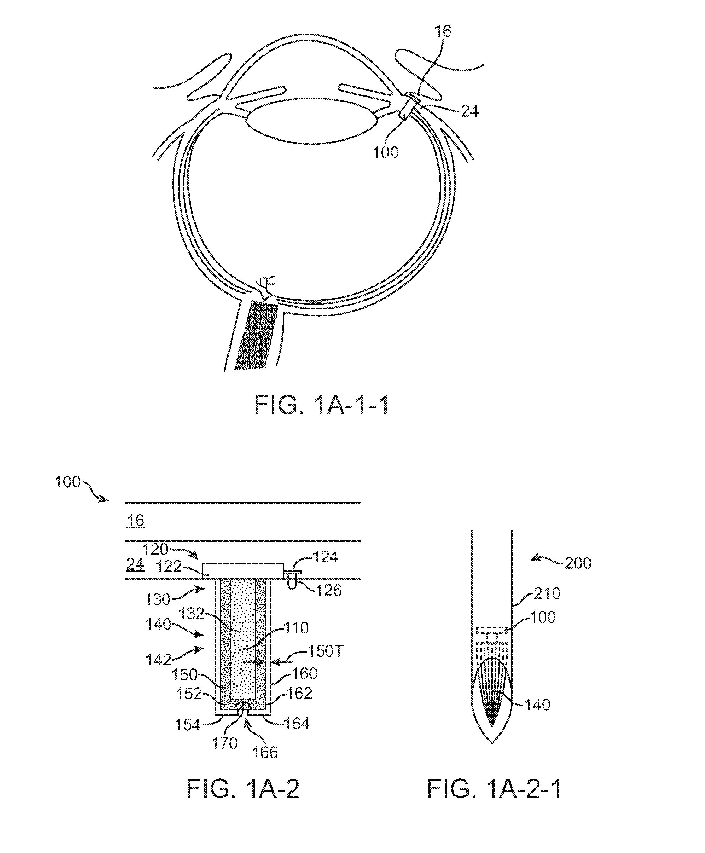 Injector apparatus and method for drug delivery