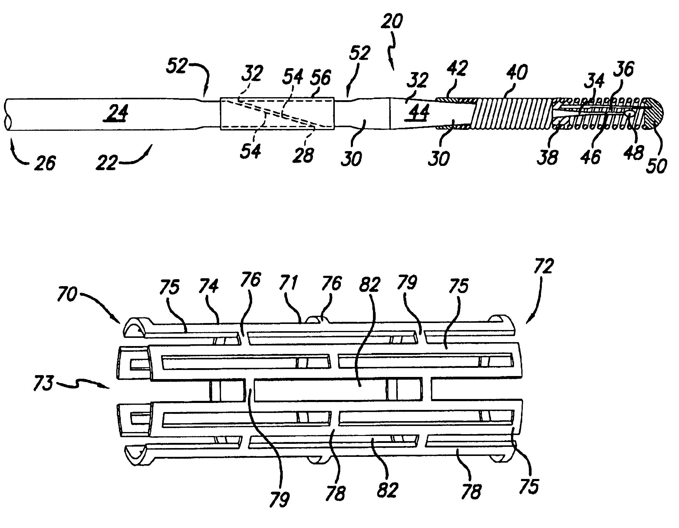 Enhanced method for joining two core wires