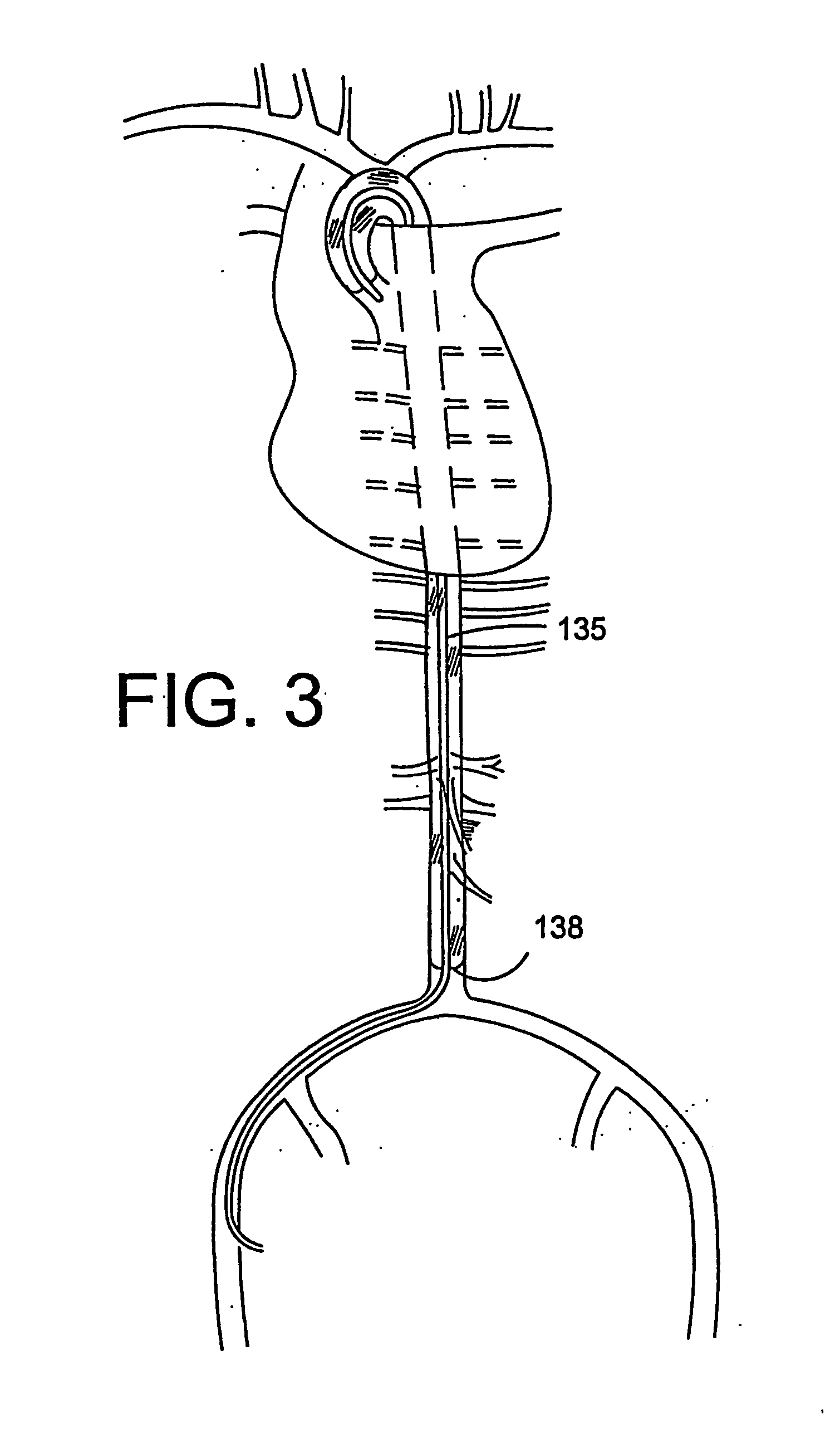 Methods, compositions and apparatus for delivering heterologous molecules to cells