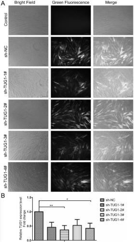 The role of lncRNA-tug1 in regulating the osteogenic differentiation and tissue regeneration of pdlscs