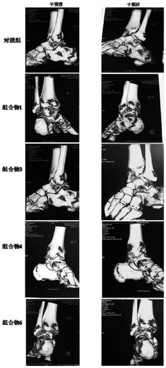 Composition capable of reducing uric acid and dissolving uric acid crystals and tophus and application of composition